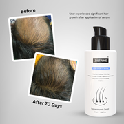 Zistrine Hair Growth SalSphere Serum