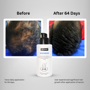 Zistrine Hair Growth SalSphere Serum