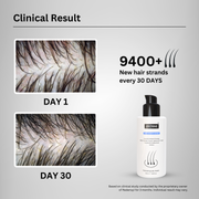 Zistrine Hair Growth SalSphere Serum