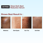Zistrine Glaze Dark Spot Reduction & Lightening Serum