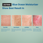 Zistrine Blue Ocean Moisturizer Water Based Gel